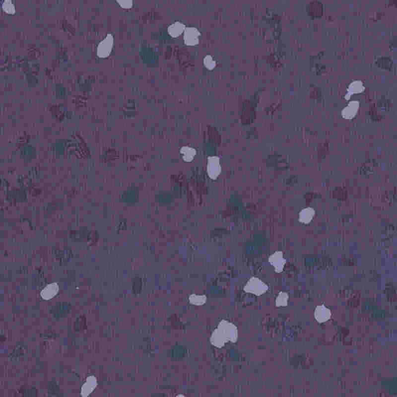 Karcálló és nagy rugalmasságú gumipadló